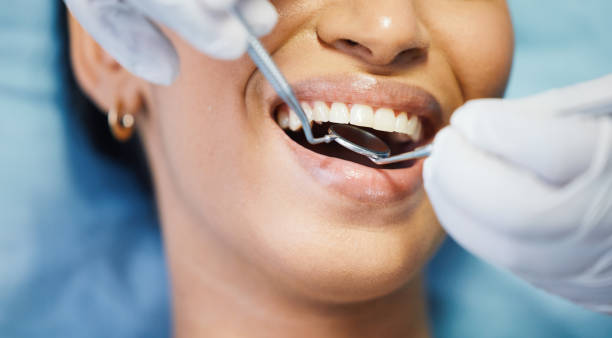 Best Emergency Dentist for Knocked-Out Tooth in Aurora, MO