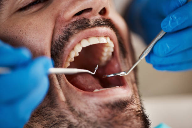 Best Broken or Cracked Tooth Emergency Dentist in Aurora, MO