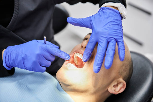 Best Emergency Dentist for Lost Fillings or Crowns in Aurora, MO
