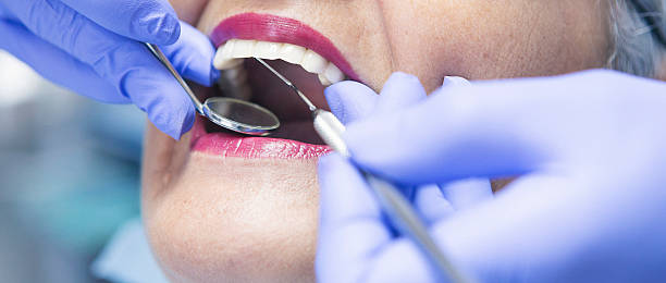 Best Holiday Emergency Dentist in Aurora, MO